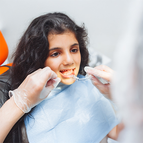 Invisalign Aligners 1