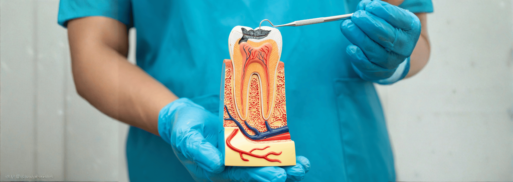root canal treatment