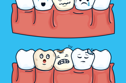 Teeth Positioning