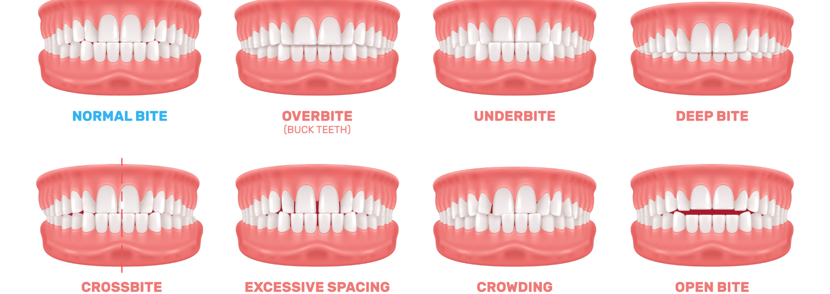 Dental Health
