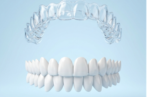 Invisalign Treatment