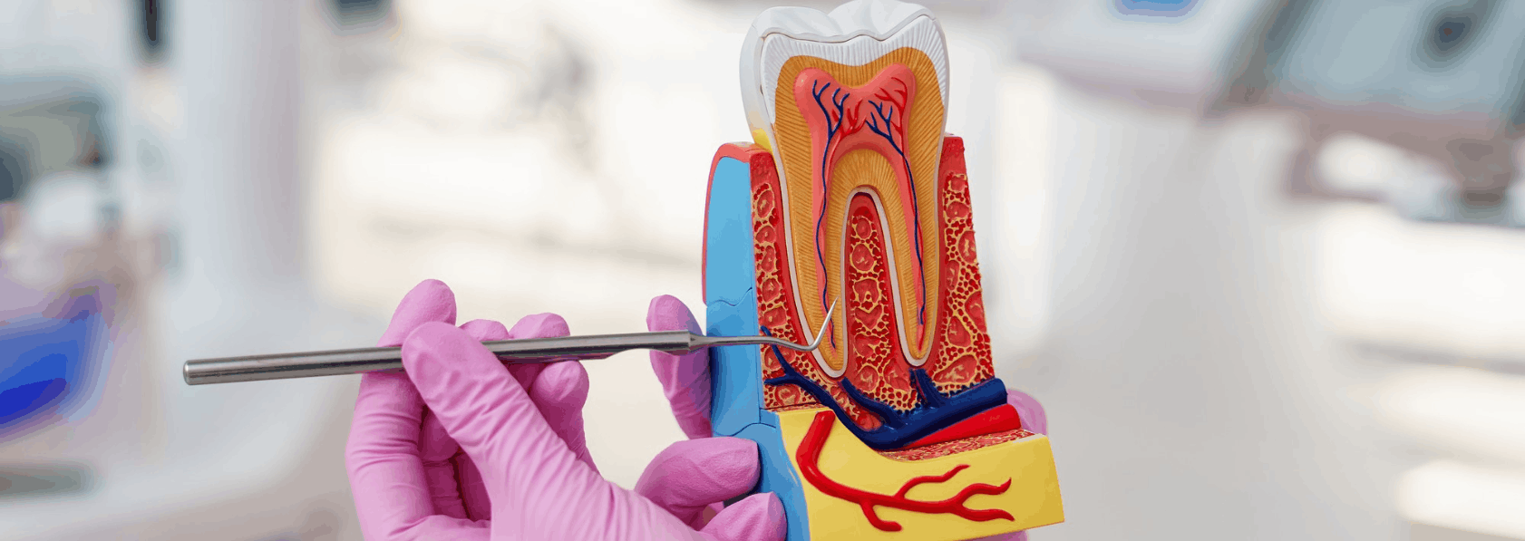 Root Canal treatment