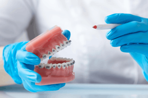 Braces Adjustment